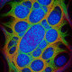 Plastic Cell Detection